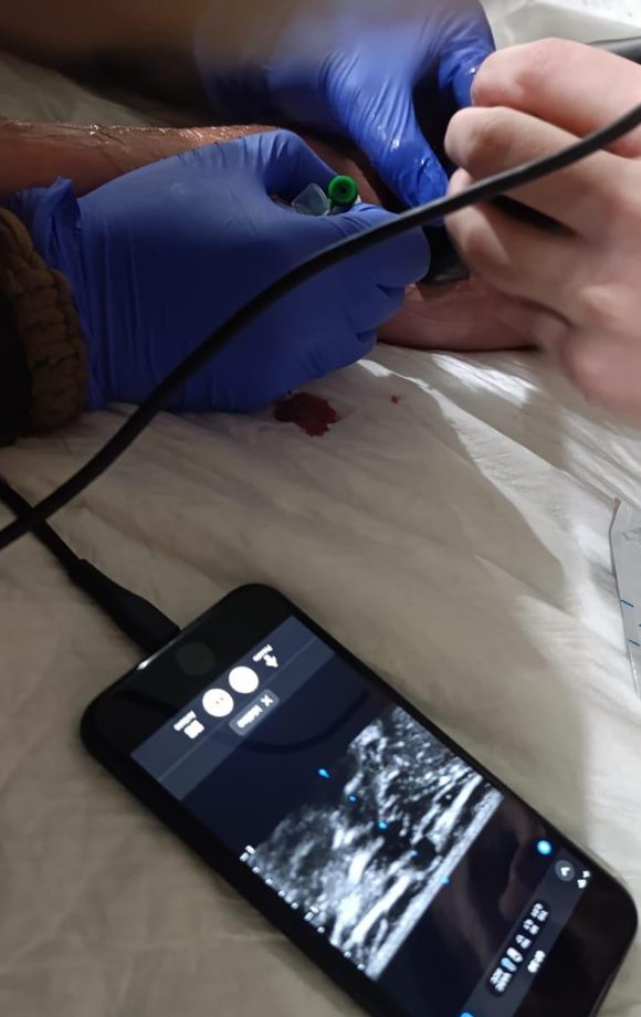 A doctor in Kharkiv with a portable ultrasound probe connected to a phone.